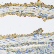 Immunohistochemistry of paraffin-embedded Human prostate using TSHB Antibody (1/100 dilution, 40x lens).