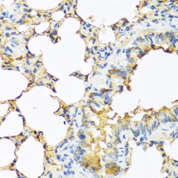Thyrotropin Subunit Beta (TSHB) Antibody
