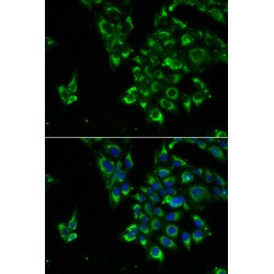 Thyrotropin Subunit Beta (TSHB) Antibody