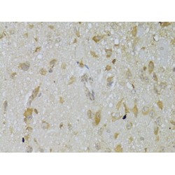 Thyrotropin Receptor (TSHR) Antibody