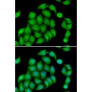 Immunofluorescence analysis of HeLa cells using ASPH Antibody