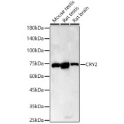 Western blot analysis of various lysates using CRY2 Antibody (1/400 dilution).