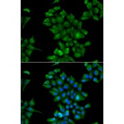 Immunofluorescence analysis of HeLa cells using CTNS Antibody