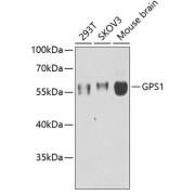 Western blot analysis of extracts of various cell lines using GPS1 Antibody (1/1000 dilution).