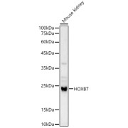Western blot analysis of Mouse kidney using HOXB7 Antibody (1/1000 dilution).
