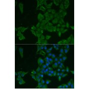 Immunofluorescence analysis of MCF7 cells using LGALS3BP Antibody