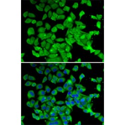 Poly A Specific Ribonuclease (PARN) Antibody