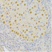 Immunohistochemistry of paraffin-embedded Rat ovary using PFKFB3 Antibody (1/100 dilution, 40x lens).