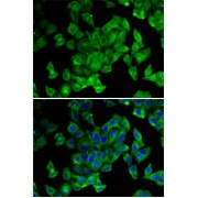 Immunofluorescence analysis of MCF7 cells using PPL Antibody
