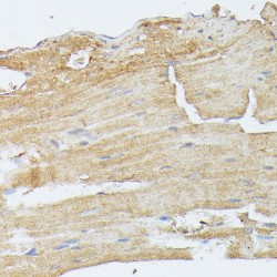 Dual Specificity Mitogen-Activated Protein Kinase Kinase 5 (MAP2K5) Antibody