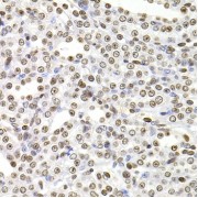Immunohistochemistry of paraffin-embedded Rat kidney using SOX5 Antibody (1/100 dilution, 40x lens).