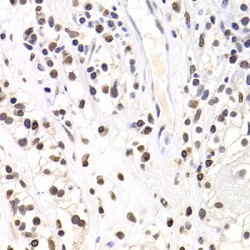 Sex Determining Region Y Box Protein 5 (SOX5) Antibody