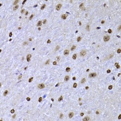 Sex Determining Region Y Box Protein 5 (SOX5) Antibody
