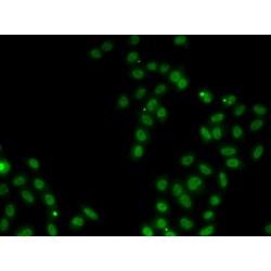 Sex Determining Region Y Box Protein 5 (SOX5) Antibody
