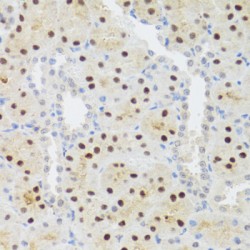 Signal Transducer And Activator of Transcription 4 (STAT4) Antibody
