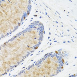 Signal Transducer And Activator of Transcription 4 (STAT4) Antibody