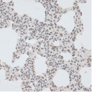 Immunohistochemistry of paraffin-embedded Rat lung using ZNF148 Antibody (1/100 dilution, 40x lens).