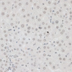 Zinc Finger Protein 148 (ZNF148) Antibody