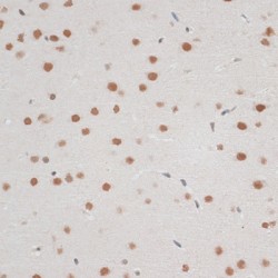 Zinc Finger Protein 148 (ZNF148) Antibody