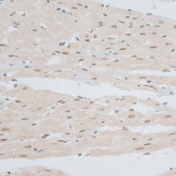 Zinc Finger Protein 148 (ZNF148) Antibody