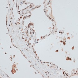 Zinc Finger Protein 148 (ZNF148) Antibody