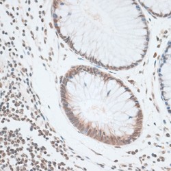 Zinc Finger Protein 148 (ZNF148) Antibody