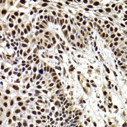 HIRA-Interacting Protein 3 (HIRIP3) Antibody
