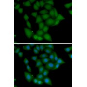 Immunofluorescence analysis of U2OS cells using CAMK1 Antibody