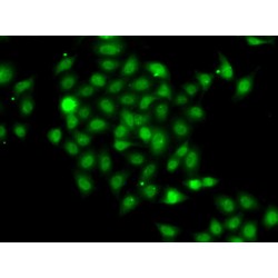 COP9 Signalosome Subunit 2 (COPS2) Antibody