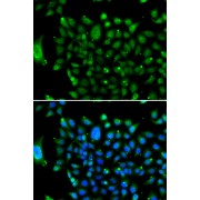 Immunofluorescence analysis of U2OS cells using NCOR1 Antibody