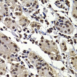 DnaJ (Hsp40) Homolog, Subfamily B, Member 6 (DNAJB6) Antibody