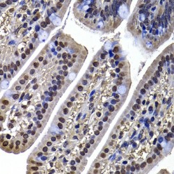 DnaJ (Hsp40) Homolog, Subfamily B, Member 6 (DNAJB6) Antibody