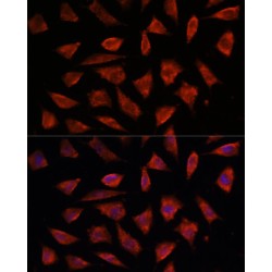 Signal Transducing Adaptor Molecule 2 (STAM2) Antibody