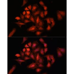 Signal Transducing Adaptor Molecule 2 (STAM2) Antibody
