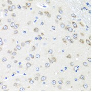 Immunohistochemistry of paraffin-embedded Rat brain using PIAS3 Antibody (1/100 dilution, 40x lens).