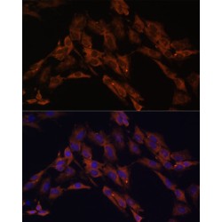 Ecto-NOX Disulfide-Thiol Exchanger 2 (ENOX2) Antibody