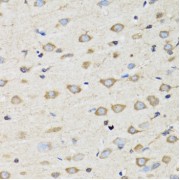 Immunohistochemistry of paraffin-embedded Rat brain using CLIC4 Antibody (1/100 dilution, 40x lens).
