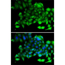 Chloride Intracellular Channel Protein 4 (CLIC4) Antibody