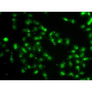 Immunofluorescence analysis of A549 cells using L3MBTL1 Antibody
