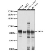 Western blot analysis of extracts of various cell lines using Sall4 Antibody (1/1000 dilution).