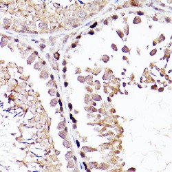Sal-Like Protein 4 (SALL4) Antibody