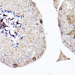Sal-Like Protein 4 (SALL4) Antibody