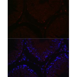Sal-Like Protein 4 (SALL4) Antibody