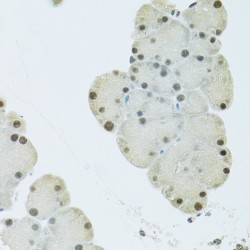 Pre-mRNA 3'-End-Processing Factor FIP1 (FIP1L1) Antibody