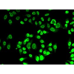 Pre-mRNA 3'-End-Processing Factor FIP1 (FIP1L1) Antibody