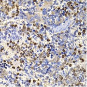 Immunohistochemistry of paraffin-embedded Rat spleen using UBASH3B Antibody (1/100 dilution, 40x lens).
