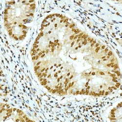 Histone Cluster 2, H4b (HIST2H4B) Antibody
