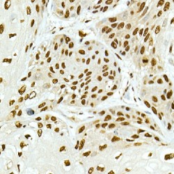 Histone Cluster 2, H4b (HIST2H4B) Antibody