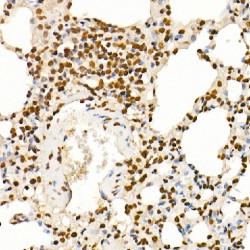 Histone Cluster 2, H4b (HIST2H4B) Antibody