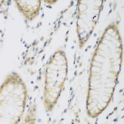 Putative N-Acetyltransferase 8B (NAT8B) Antibody